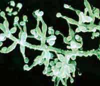 La découverte en 1972 des propriétés immunosuppressives de la cyclosporine par Jean-François Borel transforme radicalement les perspectives des greffes et la durée de vie des greffons. 